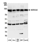 Western Blot - Anti-SERCA2 ATPase Antibody (A295499) - Antibodies.com