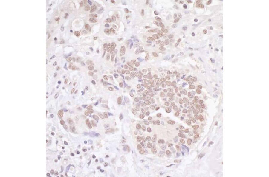 Immunohistochemistry - Anti-TBLR1 Antibody (A295501) - Antibodies.com