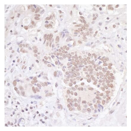 Immunohistochemistry - Anti-TBLR1 Antibody (A295501) - Antibodies.com