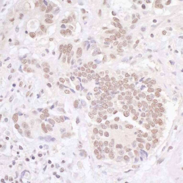 Immunohistochemistry - Anti-TBLR1 Antibody (A295501) - Antibodies.com