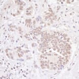 Immunohistochemistry - Anti-TBLR1 Antibody (A295501) - Antibodies.com