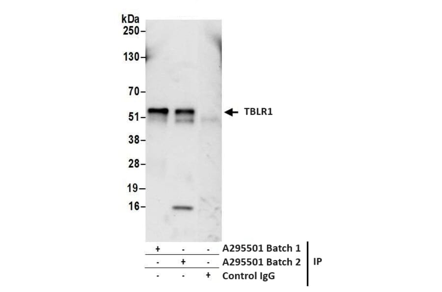 Immunoprecipitation - Anti-TBLR1 Antibody (A295501) - Antibodies.com