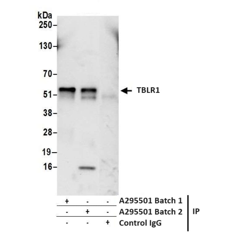 Immunoprecipitation - Anti-TBLR1 Antibody (A295501) - Antibodies.com