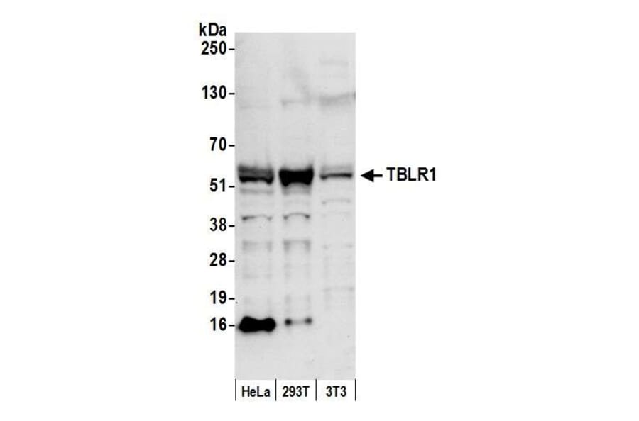 Western Blot - Anti-TBLR1 Antibody (A295501) - Antibodies.com