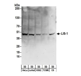 Western Blot - Anti-LIS1 Antibody (A295502) - Antibodies.com