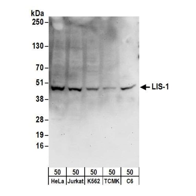 Western Blot - Anti-LIS1 Antibody (A295502) - Antibodies.com
