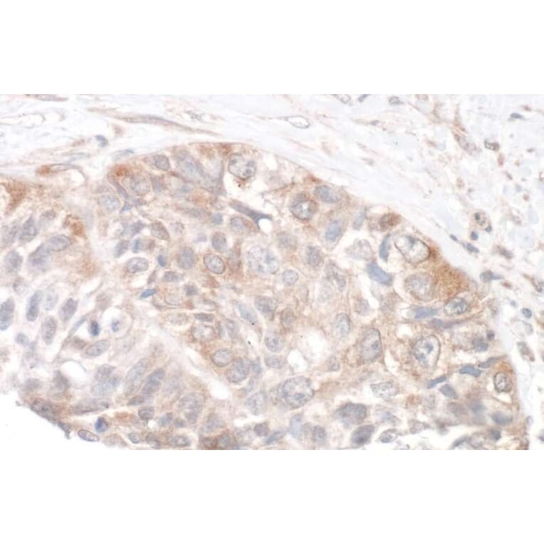 Immunohistochemistry - Anti-RICTOR Antibody (A295540) - Antibodies.com