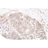 Immunohistochemistry - Anti-RICTOR Antibody (A295540) - Antibodies.com