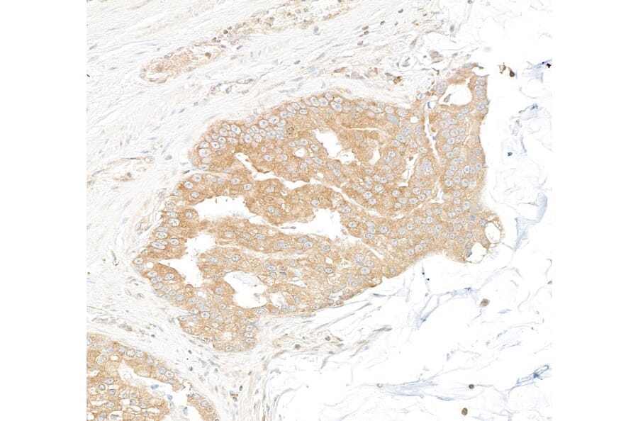 Immunohistochemistry - Anti-DDX6 Antibody (A295541) - Antibodies.com