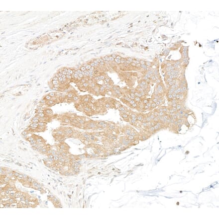 Immunohistochemistry - Anti-DDX6 Antibody (A295541) - Antibodies.com