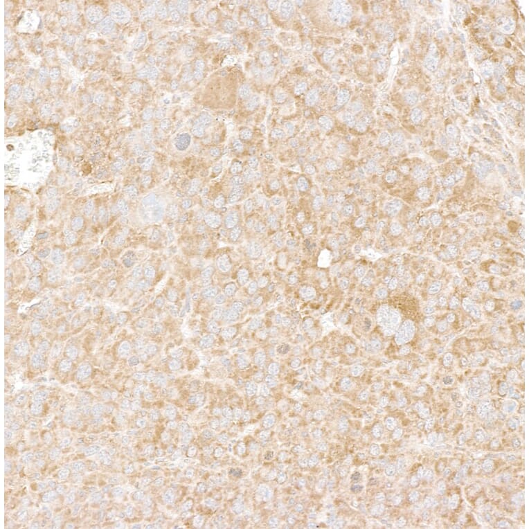 Immunohistochemistry - Anti-DDX6 Antibody (A295541) - Antibodies.com