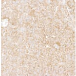 Immunohistochemistry - Anti-DDX6 Antibody (A295541) - Antibodies.com