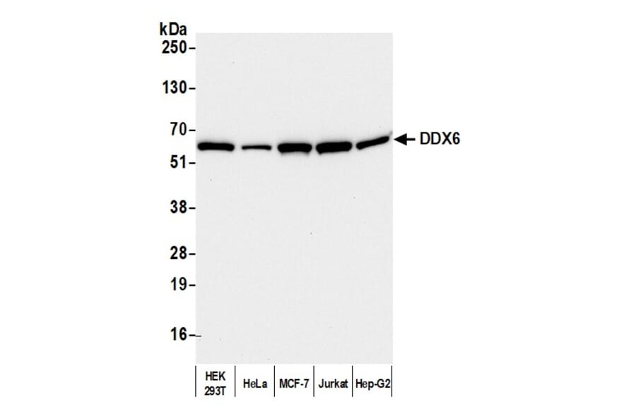 Western Blot - Anti-DDX6 Antibody (A295541) - Antibodies.com