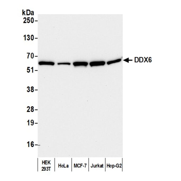 Western Blot - Anti-DDX6 Antibody (A295541) - Antibodies.com
