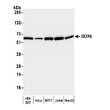 Western Blot - Anti-DDX6 Antibody (A295541) - Antibodies.com