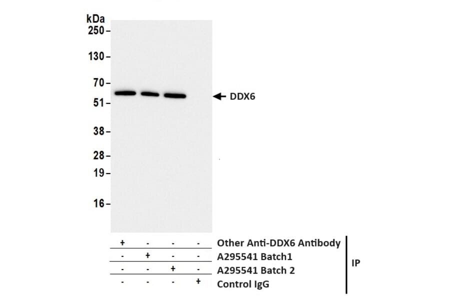 Immunoprecipitation - Anti-DDX6 Antibody (A295541) - Antibodies.com