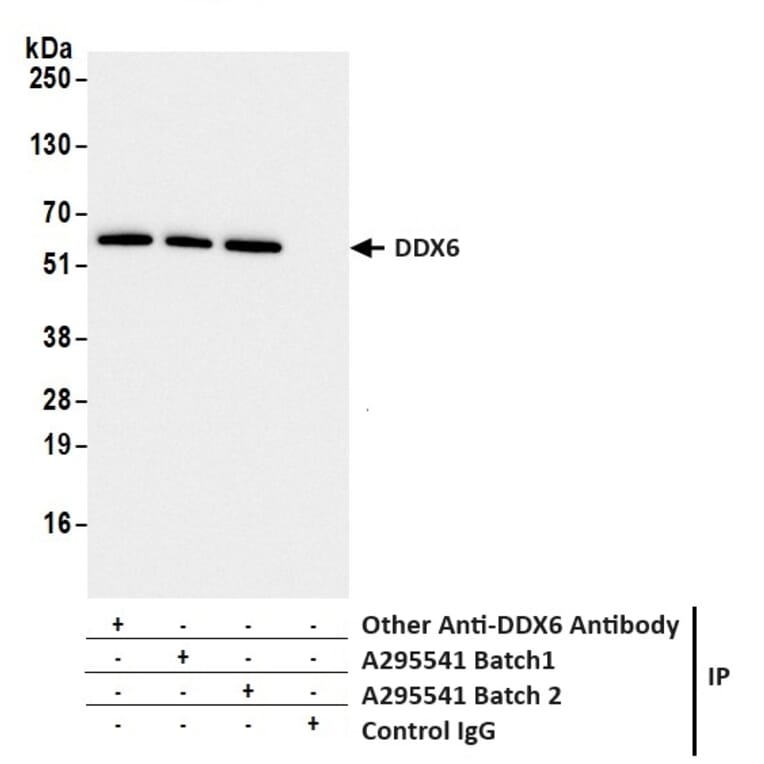 Immunoprecipitation - Anti-DDX6 Antibody (A295541) - Antibodies.com