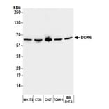 Western Blot - Anti-DDX6 Antibody (A295541) - Antibodies.com