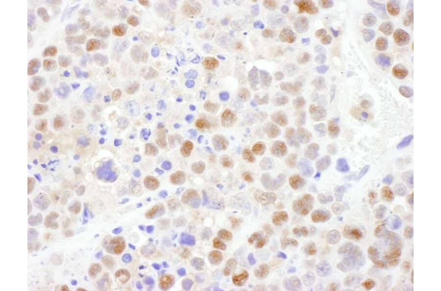 Immunohistochemistry - Anti-CRM1 Antibody (A295552) - Antibodies.com