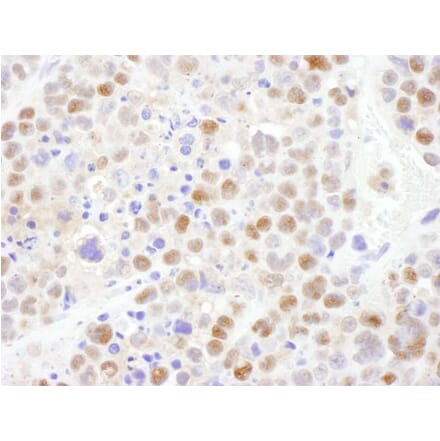 Immunohistochemistry - Anti-CRM1 Antibody (A295552) - Antibodies.com