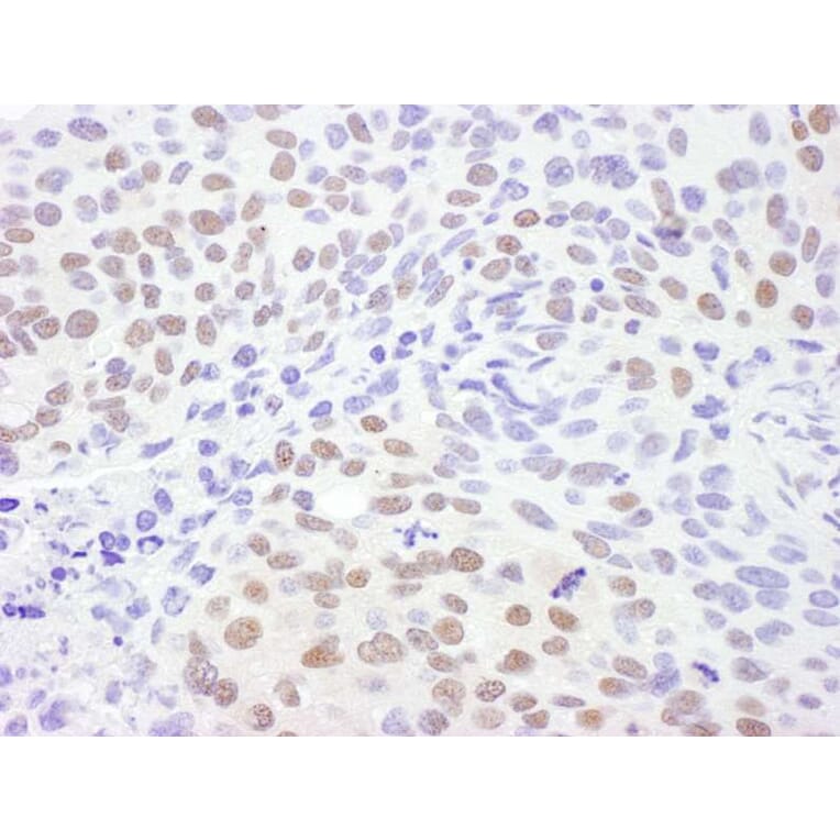 Immunohistochemistry - Anti-CRM1 Antibody (A295552) - Antibodies.com
