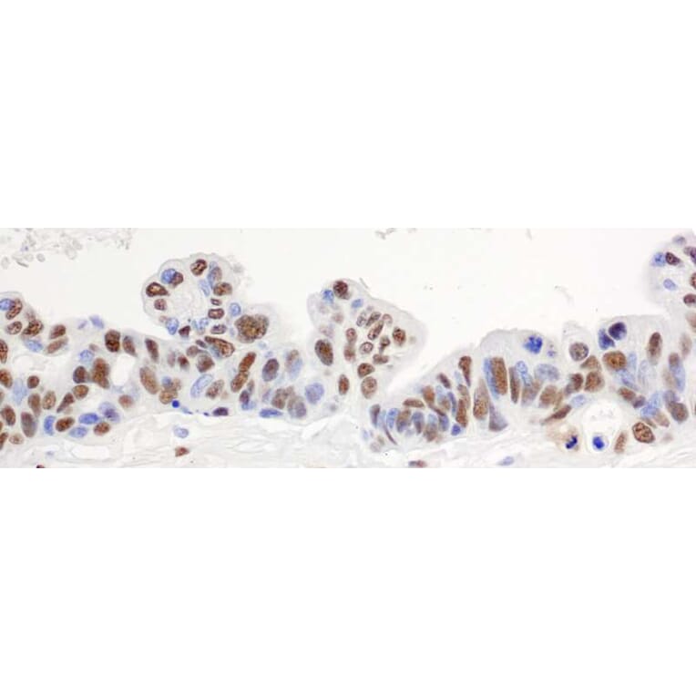 Immunohistochemistry - Anti-hnRNP-H Antibody (A295588) - Antibodies.com