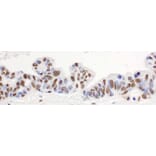 Immunohistochemistry - Anti-hnRNP-H Antibody (A295588) - Antibodies.com