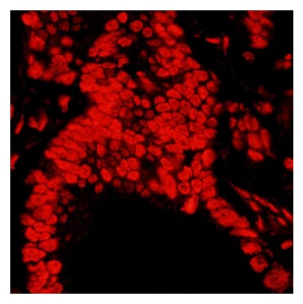 Immunohistochemistry - Anti-Matrin 3 Antibody (A295660) - Antibodies.com