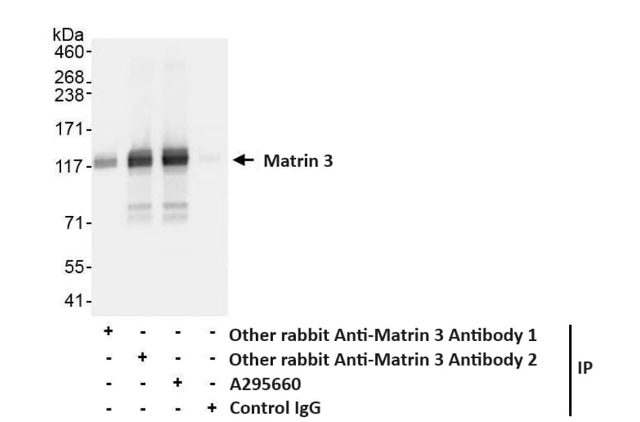 Immunoprecipitation - Anti-Matrin 3 Antibody (A295660) - Antibodies.com