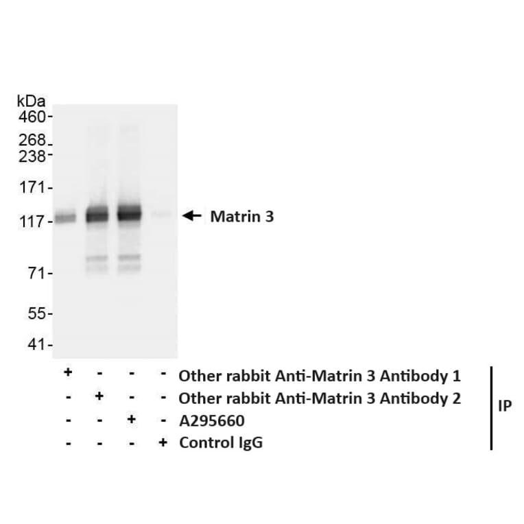 Immunoprecipitation - Anti-Matrin 3 Antibody (A295660) - Antibodies.com
