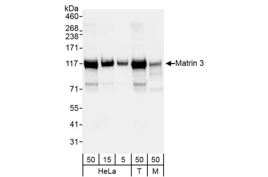Western Blot - Anti-Matrin 3 Antibody (A295660) - Antibodies.com