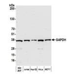 Western Blot - Anti-GAPDH Antibody (A295699) - Antibodies.com