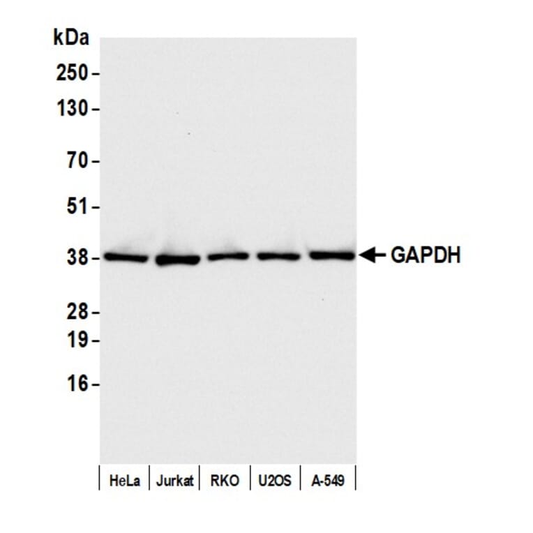 Western Blot - Anti-GAPDH Antibody (A295702) - Antibodies.com