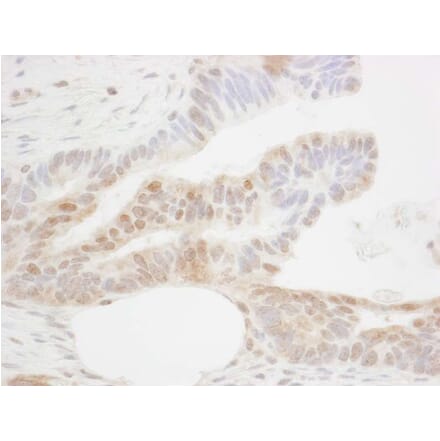 Immunohistochemistry - Anti-CDX2 Antibody (A295741) - Antibodies.com
