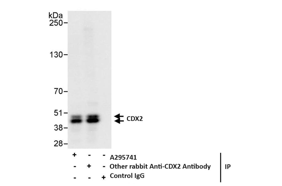 Immunoprecipitation - Anti-CDX2 Antibody (A295741) - Antibodies.com