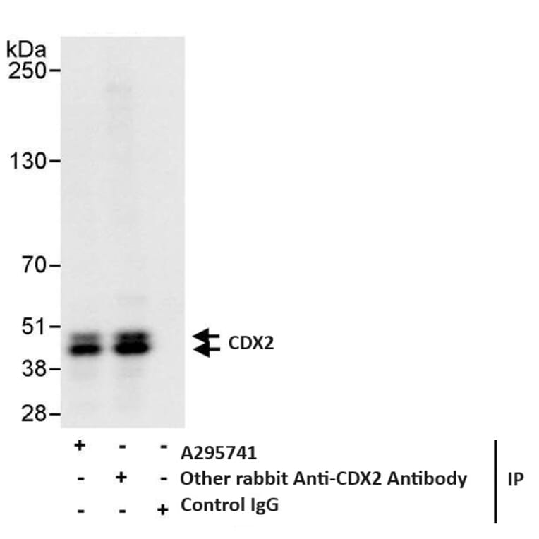 Immunoprecipitation - Anti-CDX2 Antibody (A295741) - Antibodies.com