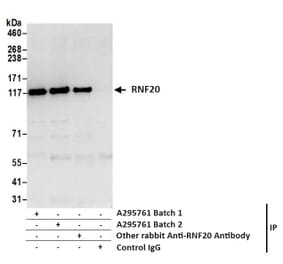 Immunoprecipitation - Anti-RNF20 Antibody (A295761) - Antibodies.com