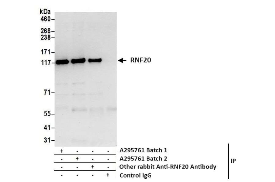 Immunoprecipitation - Anti-RNF20 Antibody (A295761) - Antibodies.com