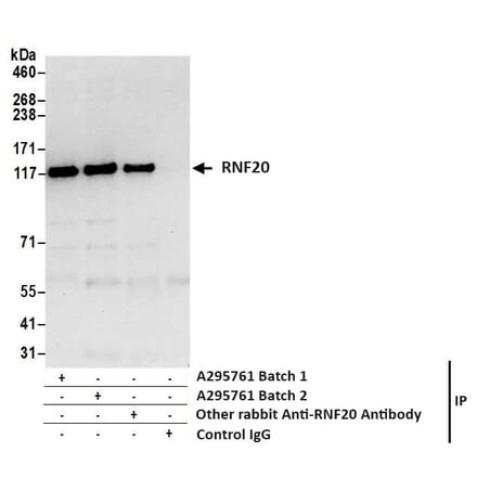 Immunoprecipitation - Anti-RNF20 Antibody (A295761) - Antibodies.com