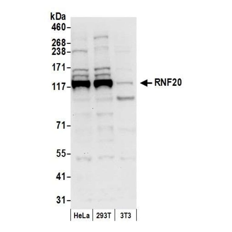 Western Blot - Anti-RNF20 Antibody (A295761) - Antibodies.com
