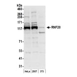 Western Blot - Anti-RNF20 Antibody (A295761) - Antibodies.com