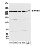 Western Blot - Anti-MED12 Antibody (A295806) - Antibodies.com