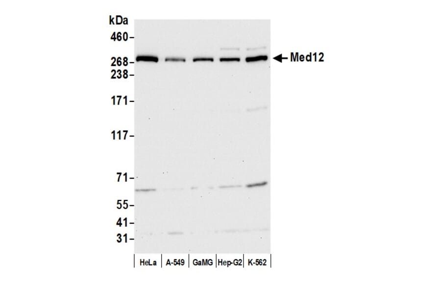 Western Blot - Anti-MED12 Antibody (A295806) - Antibodies.com