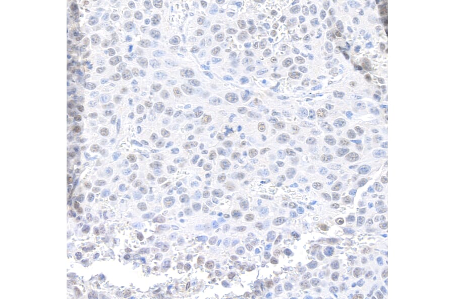 Immunohistochemistry - Anti-MED12 Antibody (A295806) - Antibodies.com