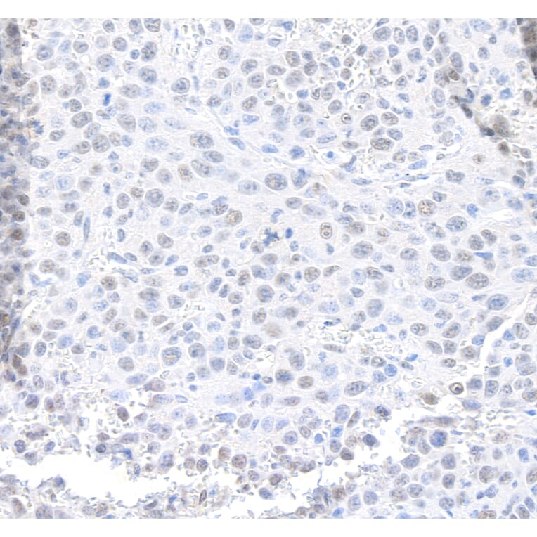 Immunohistochemistry - Anti-MED12 Antibody (A295806) - Antibodies.com