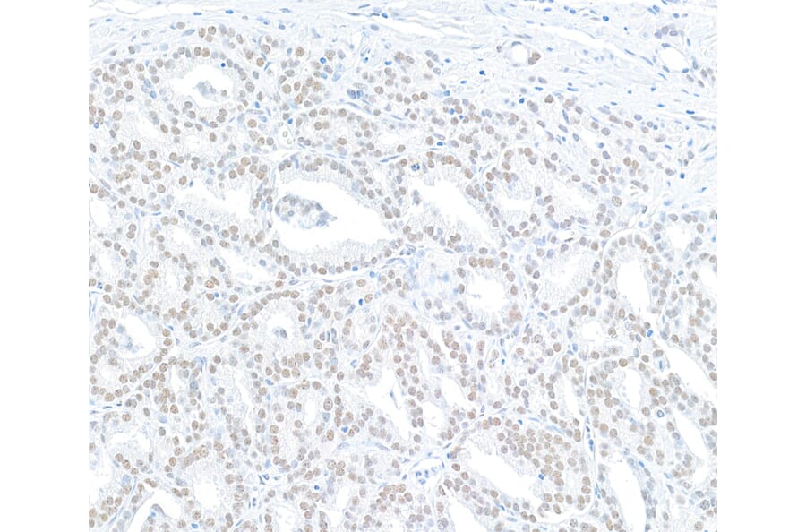 Immunohistochemistry - Anti-MED12 Antibody (A295806) - Antibodies.com