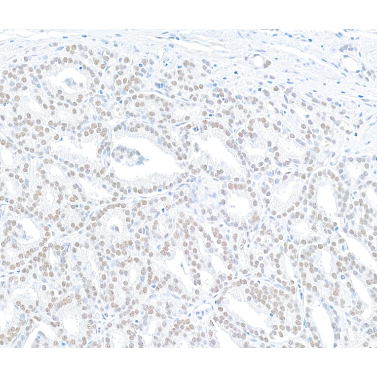 Immunohistochemistry - Anti-MED12 Antibody (A295806) - Antibodies.com