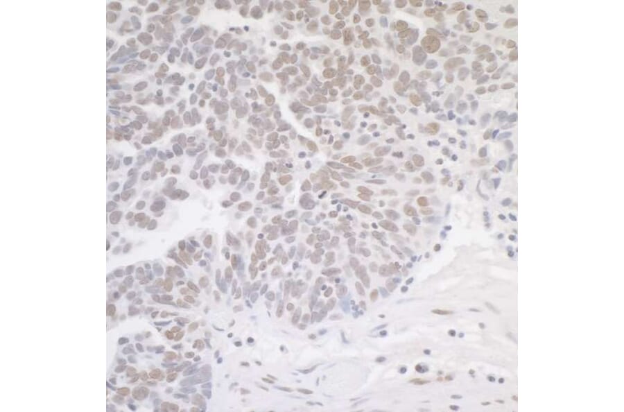 Immunohistochemistry - Anti-MED12 Antibody (A295806) - Antibodies.com