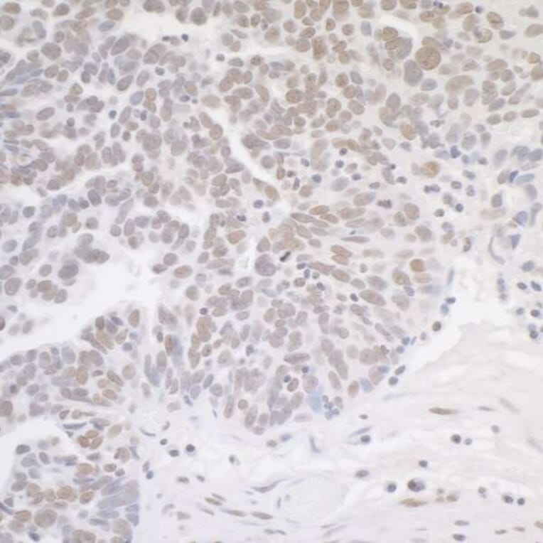 Immunohistochemistry - Anti-MED12 Antibody (A295806) - Antibodies.com