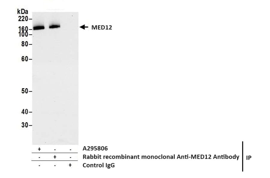 Immunoprecipitation - Anti-MED12 Antibody (A295806) - Antibodies.com